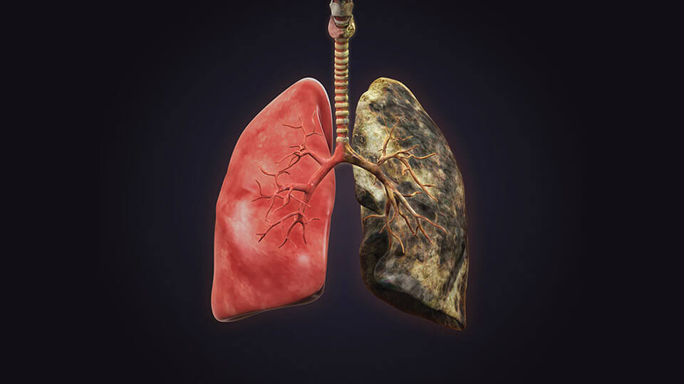 “Sigarayı Bırakmak Kanser Riskini Azaltır”